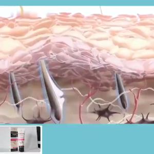 COD !! Cream Pemutih Ketiak Leher Instant - Baby Whitening Krim Pelembab Tubuh Pemutih Ketiak/Gel Krim Pencerah Lipatan Hitam Krim Lutut Ketek Leher Dengkul- Krim Pemutih Anti Ketiak Hitam-Leher Firming Peremajaan Krim Anti-krim pemutih badan