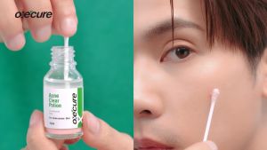 [แพ็ค 2] Oxecure Acne Clear Potion 15ml แป้งน้ำชมพู