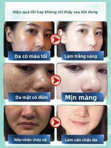 ORKY | Whitening Spot-Reducing Face Cream