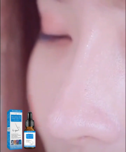 WEST&MONTH Essential Oil Nose Lift Up Nasal Bridge Lifting Liquid Nasal Lifting Moisturizing Massage Essence 10ml