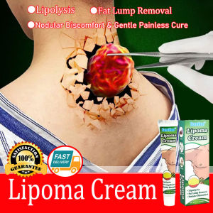 [Original] Lipoma Cream Fat Elimination Cream 20g Removing Lumps in the Body Fat Lump Relieve Plaster Skin Swelling Ointment Subcutaneous Lumps Dredge health care