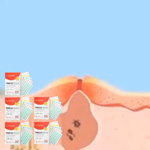 200pcs Colorful Cute Shaped Acne Treatment Sticker Invisible Acne Cover Removal Pimple Patch Skin Care