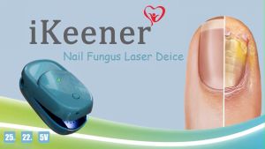 IKeener Nail Fungus Laser 905Nm Phototherapy Paronychia Foot Paronychia Foot Care Home Phototherapy Paronychia Mini Toenail Onychomycosis Therapy Led Cure
