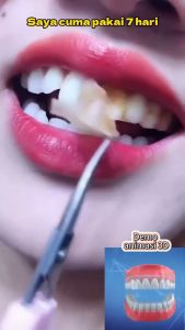 7 pairs of teeth whitening veneers to remove stains remove yellowing whiten and whiten teeth dry veneers Cleaning Strong Enzyme Dental Mask Veneers