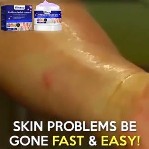 Atoderma Cream: Fast Itch Relief & Antifungal Skin Care