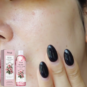 HOYGI Rose Hydrating Toner Moisturizing Repair Skin Barrier โทนเนอร์กุหลาบให้ความชุ่มชื้น บำรุงผิว ซ่อมแซมเกราะป้องกันผิว เพิ่มความกระจ่างใส ไม่เหนียวเหนอะหนะ
