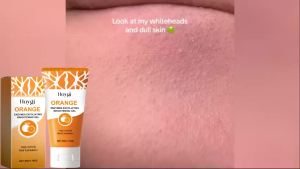 Gel Tẩy Mụn Đầu Đen Tẩy Tế Bào Chết Làm Sạch Sâu Lỗ Chân Lông Kiểm Soát Dầu Thu Nhỏ Lỗ Chân Lông Chăm Sóc Da Mặt - Loại Bỏ Da Chết