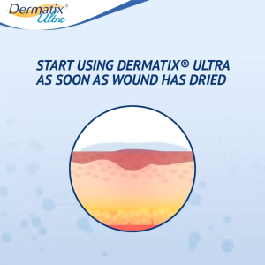 100% genuine scar removal cream stretch mark cream scar removal cream 15g promotes skin repair softens cuticles fades scars moisturizes the skin gentle and does not hurt the skin