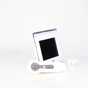 foreverlily 2 IN 1 Skin and Hair Machine Skin Pores Comprehensive Analysis HD Display of Scalp Skin and Hair Machine