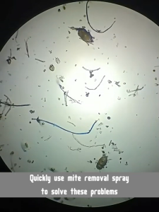 No wash 💦Dust Mite & Bed Bug Spray 500ML Kills up to 99.9% of mites No sun non-irritating Bed Bug Spray Killer Kills mites No more itching or redness suitable for children Mite Remover 除螨喷雾