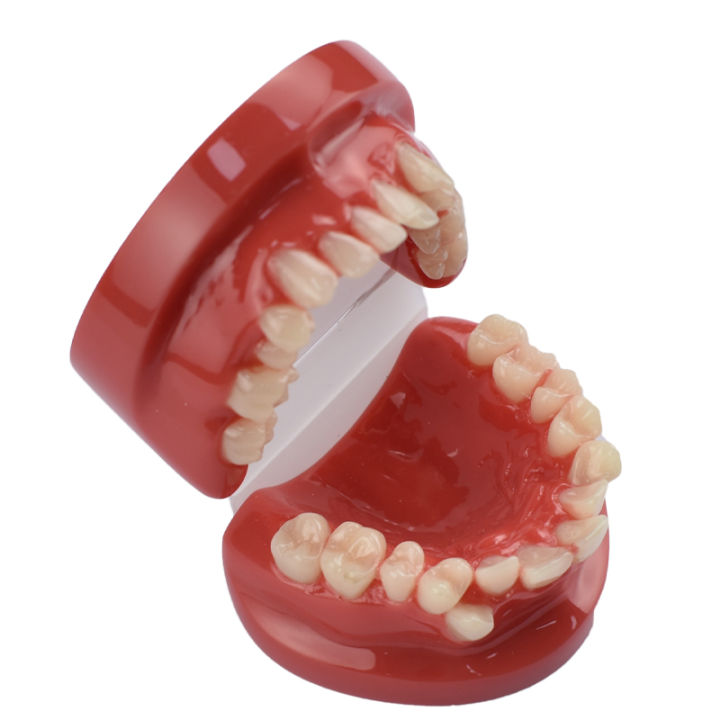 3D Resin Dental Model Teeth Malocclusion Model For Demostration Teaching Dental Students Study Oral Dentistry Products