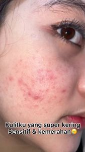 Skincare Untuk Anak Serum Wajah Untuk Anak 9 10 11 12 13 14 th Serum wajah untuk Remaja Serum wajah Untuk Dewasa