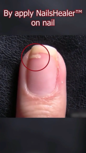 EELHOE Nail Repair 50ml | Krim Obat Jamur Kuku Berjamur & Vitamin Perawatan Kuku Rusak