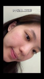 Bundle of 1/2/3 Life-Space Acne Relief +Skin Rebalance Probiotic 30 Capsules (EXP: 2027/01) Relieves Acne Pimples & lmflammation，Supports Skin Regeneration & Smoothness 减少痤疮 修复肌肤