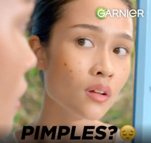 Garnier 4% Anti Acne Salicylic Acid Serum with Vitamin C Niacinamide AHA (15ml) - Skincare for pimple open pores acne prone skin