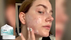 【BUY 1 TAKE 1】Eelhoe Dark Spot Corrector Cream 30g Whitening Freckle Cream Remover Melasma Acne Melanin Pigmentation With Collagen Anti-Aging Wrinkle Oil Control Brightening Moisturizing Nourishing Skin Care  ﻿