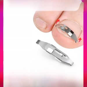 คลิปแก้ไขเล็บ เครื่องมือแก้ไขเล็บ神