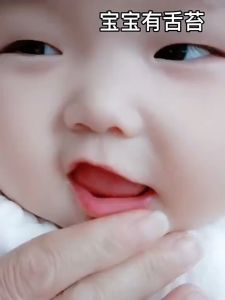 Sikat Lidah Gigi Bayi Silikon 0-18 Bulan Plus Gelas BPA FREE | Perawatan Gusi Anak Bayi