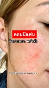 💦วิตามินผิวขาว💦TM VITZU C วิตามินซี วิตามินเข้มข้น vitamin ผิวขาวใส