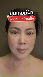 [ส่งฟรี] เซตสยบสิว ฝ้า จาง ตัดวงจรฝ้า ป้องกันแสงแดด (ครีมฝ้า Dr.JiLL 2 หลอด + ครีมกันแดด Perfect cover 1 หลอด + สบู่ JiLSOAP 2 ก้อน 1)