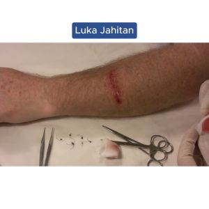 Obat Pasca Operasi Caesar Luka Cepat Kering Paling Ampuh Exstrak Ikan Gabus