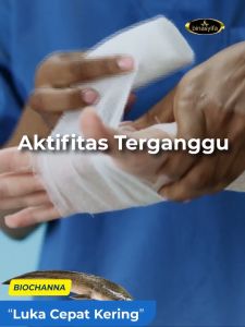 Kapsul Ikan Gabus BIOCHANNA BPOM Binasyifa