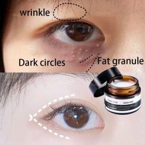 Eye Cream: Solusi Anti-Keriput & Anti-Bengkak Untuk Mata