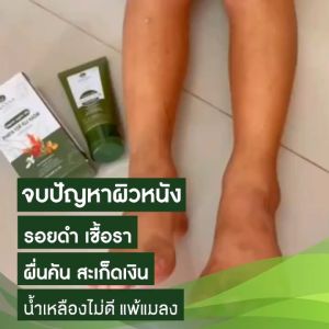 ครีมพญายอ พูลคาว สมุนไพรไทย 100% ส่งฟรี ยาทาแก้คัน ขายหนัง น้ำเหลือง ป้องกันเชื้อรา ส้นเท้าแตก สมัครงานแก้คันดูแลผิว