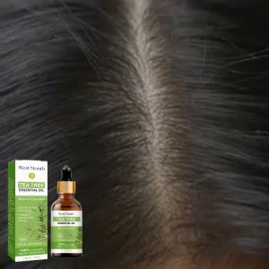 West&Month เซรั่มจากสารสกัดทีทรีเข้มข้น Tea Tree Essential Serum Oil ช่วยปรับผิวหน้าให้เรียบเนียน บำรุงผิวหน้าให้กระชับ ซ่อมแซมเส้นผม Oil Control Fade Acne Marks เซรั่มทีทรี ยับยั้งสิว