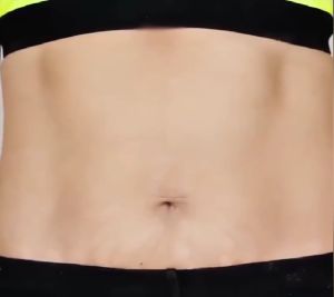 Stretch mark cream Krim stretch mark Secara efektif mengh1langkan stretch mark Tujuh hari untuk mengh1langkan stretch mark dengan cepat | stretch mark oil