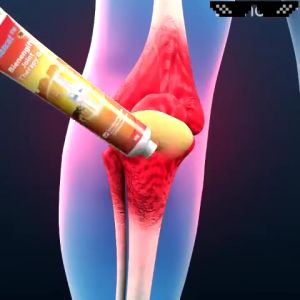 【BUY 1 TAKE 1】Bee Venom Joint Relief Cream Treatment Gel 20g joint and bone relief cream bee venom supplement treat lumbar spine cervical spine musculoskeletal pain professional treatment kneeshoulder neckwaist and leg gel