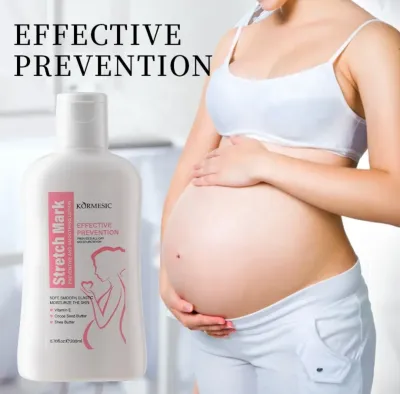 Effective Lotion for Stretchmark Prevention Tummy Smoothing Lotion Pregnancy Care 200ml