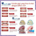 ismileusa teeth trainer / parapih gigi original / alat perapi gigi / tethtrainer alignment / perapi gigi tongos / perapi gigi maju / perapat gigi/ alat merapikan gigi / behel lepas pasang / perapih gigi rengang / karet gigi. 