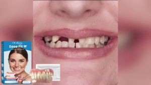 Full Denture Set Enhance Chewing Ability Fill Missing Teeth Broken Cover Promote Smile Tooth Soft Silicone False Teeth Braces