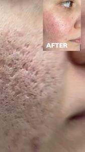 Taboya Deep Treatment Pink - Serum Taboya Brightening Pink