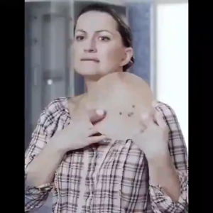 Warts Remover Original Watson Warts Removal Mole And Warts Remover Skin Tags And Warts Remover Cream Pangtanggal Kulogo Buni An An Nunal Mole Milia Syringoma 30g