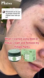 Blem Dr The Ultimate Pekas Cream & Toner Whitening Exfoliating Rejuvenating Moisturizer Face Cream Beauty Skin Care Niacinamide Aloe Vera Calamansi Dark Spot Melasma Freckles Pore Pimple Acne Blackheads Oil Control Anti Aging Glass Skin For Men & Women