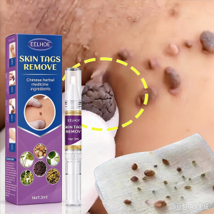 Fast-Acting Wart Removal Pen Anti-Moles Liquid Pen 3ml Remover Serum For Tag Mole & Callus