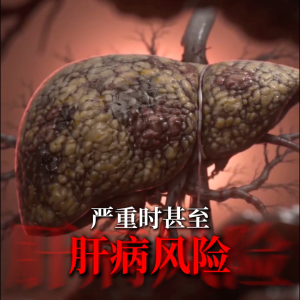 【黄叔平】平干素 | 中医护肝配方 | 清肝毒 降肝火 | 肝指数 肝硬化 脂肪肝 | 改善消化不良 口干口苦 睡不好 熬夜疲劳 | 48年中医世家 | 1盒80粒