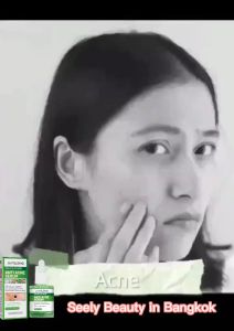 ครีมกำจัดสิว 30ml อ่อนโยนไม่ระคายเคือง Jayusing เซรั่มแต้มสิ ลดไรและสิวตามร่างกาย กำจัดสิวที่หลังและลำตัว ครีมแต้มสิว