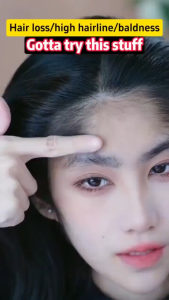 Minoxidil 5% Extra Strength Penumbuh Rambut Beard Oil Serum Penumbuh Dan Penebal Cepat Rambut Brewok Kumis Jambang 30ml Serum Penumbuh Rambut Cepat Penumbuh rambut Pengontrol Minyak Anti rambut rontok Anti ketombe