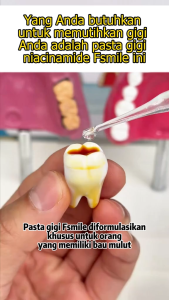 FSMILE Toothpaste Pemutih Gigi Membasmi Bakteri & Plak Sensitif Aroma Mint Segar Tahan Lama BPOM