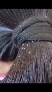 【สระผมก็กำจัดเหาได้】เหาหายไป！120MLแชมพูกำจัดเหา ธรรมชาติ ปลอดภัยไม่ระคายเคือง แชม แชมพูเหา ใช้ได้ปลอดภัยทั้งเด็กและผู้ใหญ่ บรรเทาอาการคัน ยาฆ่าเหาถาวร