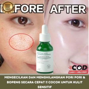 Serum Salicylid Acid penghilang komedo dan pori pori firming skin and Moisturizing 30g - i