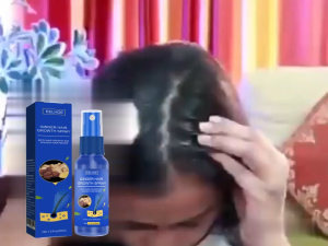 EELHOE สเปรย์ปลูกผม Ginger Hair Growth Serum Spray บอกลาหัวล้าน เร่งผมขึ้นใหม่ เร่งผมยาวไว ป้องกันผมร่วง บำรุงตั้งแต่รากผมป้องกันผมร่วง เซรั่มปลูกผม ป้องกันผมร่วงอย่างมืออาชีพ แก้ปัญหาผมร่วง น้ำยาเร่งผมยาว ปลูกผม
