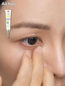 ครีมลดถุง 30ml รอยคล้ำใต้ตา ปรับปรุงผิว ครีมบำรุง ครีมทา ครีมรอบ ครีมทาขอบ รอบดวงตา ถูกสร้างขึ้นโดย AICHUN