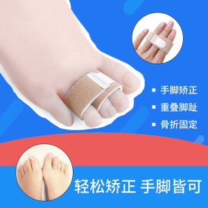 Comprehensive Guide: Adult Finger & Toe Corrector Devices & Overlapping Finger Fracture Prevention