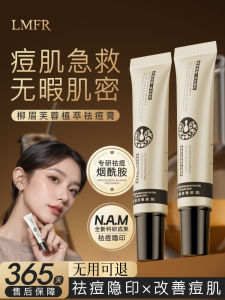 Aloe Vera Gel Facial Back Acne Treatment Fade Acne Scars Spotless Skin Cream Clear Type Face Cream for Beauty And Skincare