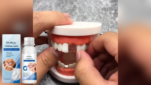 Oralhoe Thermal Gaps Moldable Teeth Filling Beads 30g Temporary Denture Repair Kit Custom Fit Non Toxic Easy Recovery Realistic Appearance Solid Dental Glue For Gaps
