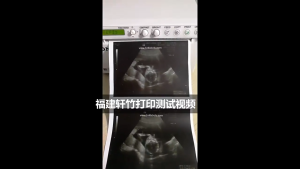 UPP-110S Ultrasound Thermal Paper Fetal Monitor Medical Imaging Paper For Sony Printers